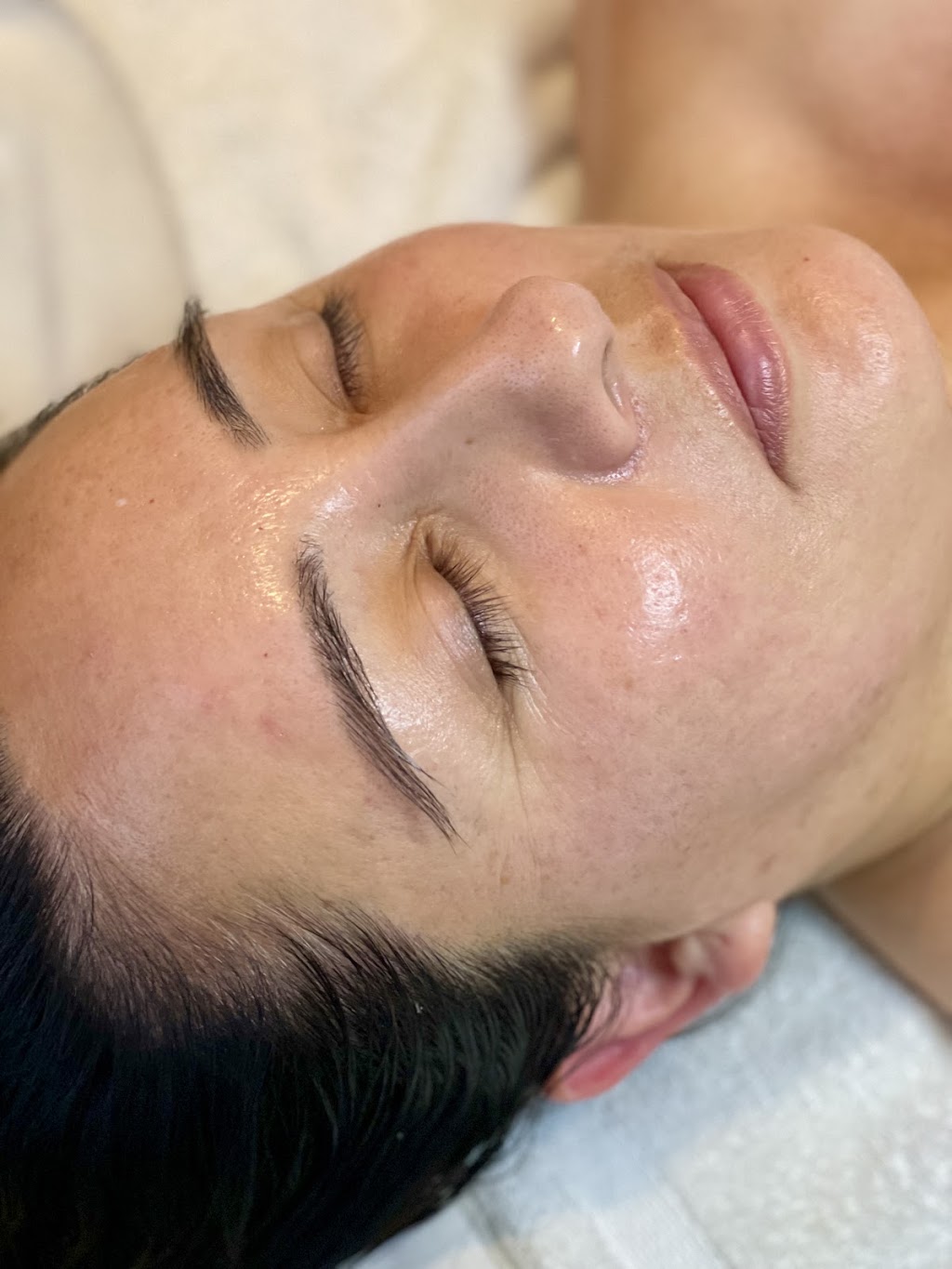 Balanced Skin and Acne Clinic | 585 Coombsville Rd, Napa, CA 94558 | Phone: (707) 227-7096