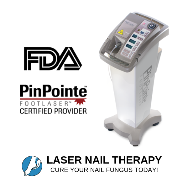 Laser Nail Therapy | 1741 Saratoga Ave #213, San Jose, CA 95129 | Phone: (408) 400-3902
