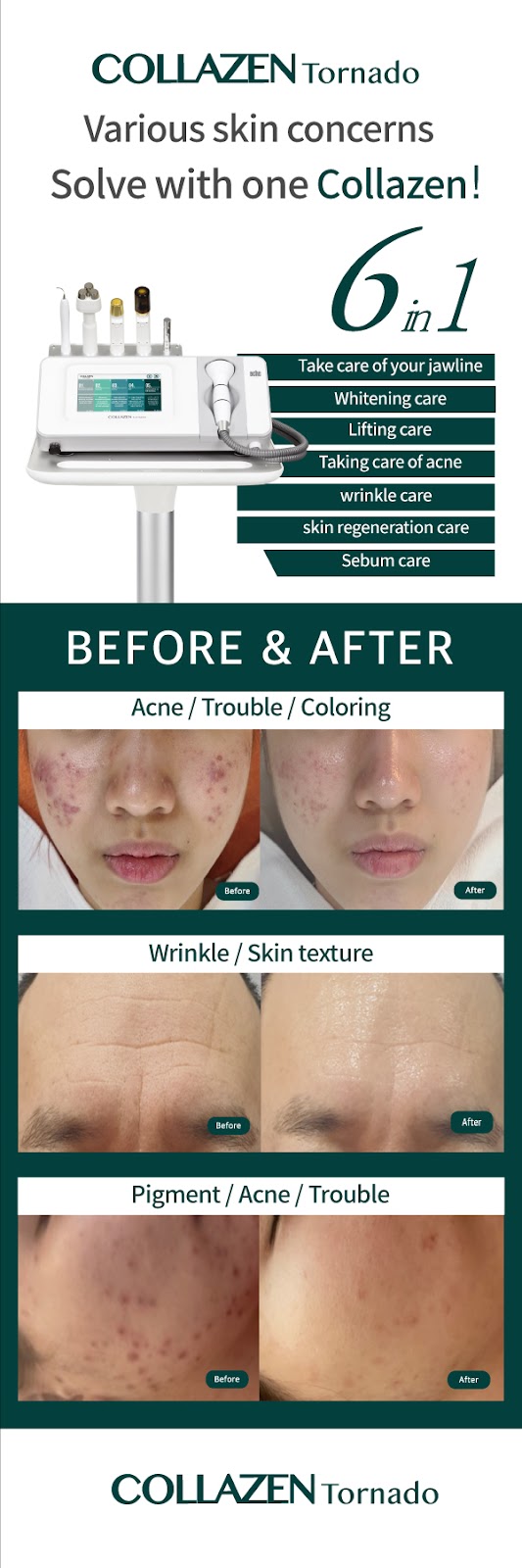 R. O. Beauty Skin Care | Inside Tracy Beauty Salon, 657 Grape Ave, Sunnyvale, CA 94087 | Phone: (408) 455-0787