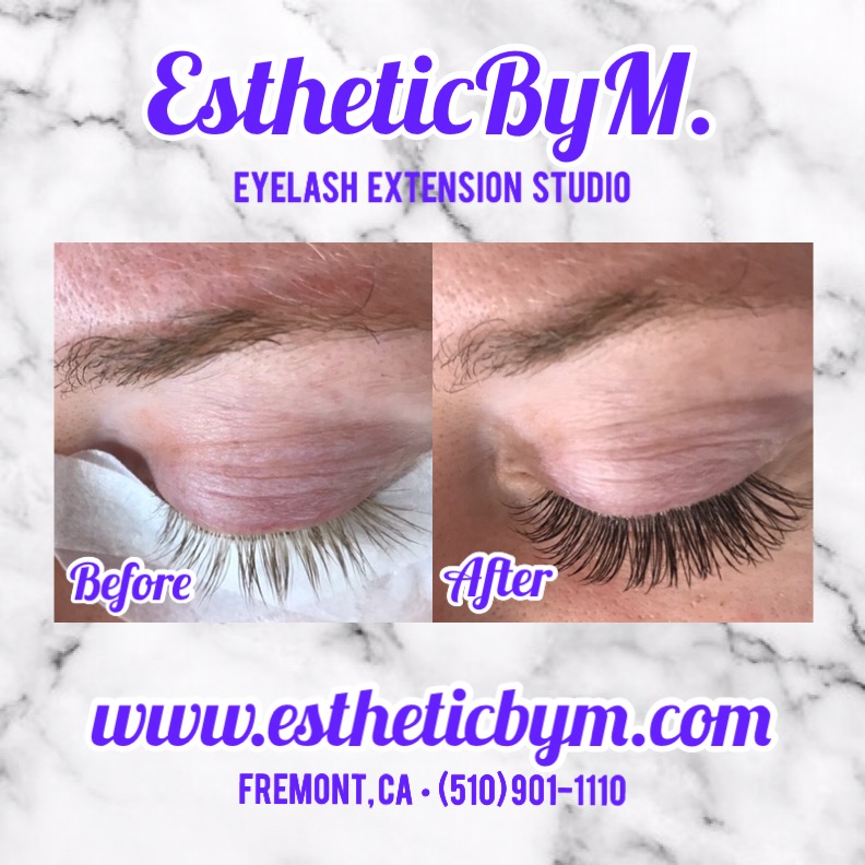 Esthetic By M | 43473 Boscell Rd j3, Fremont, CA 94538 | Phone: (510) 901-1110