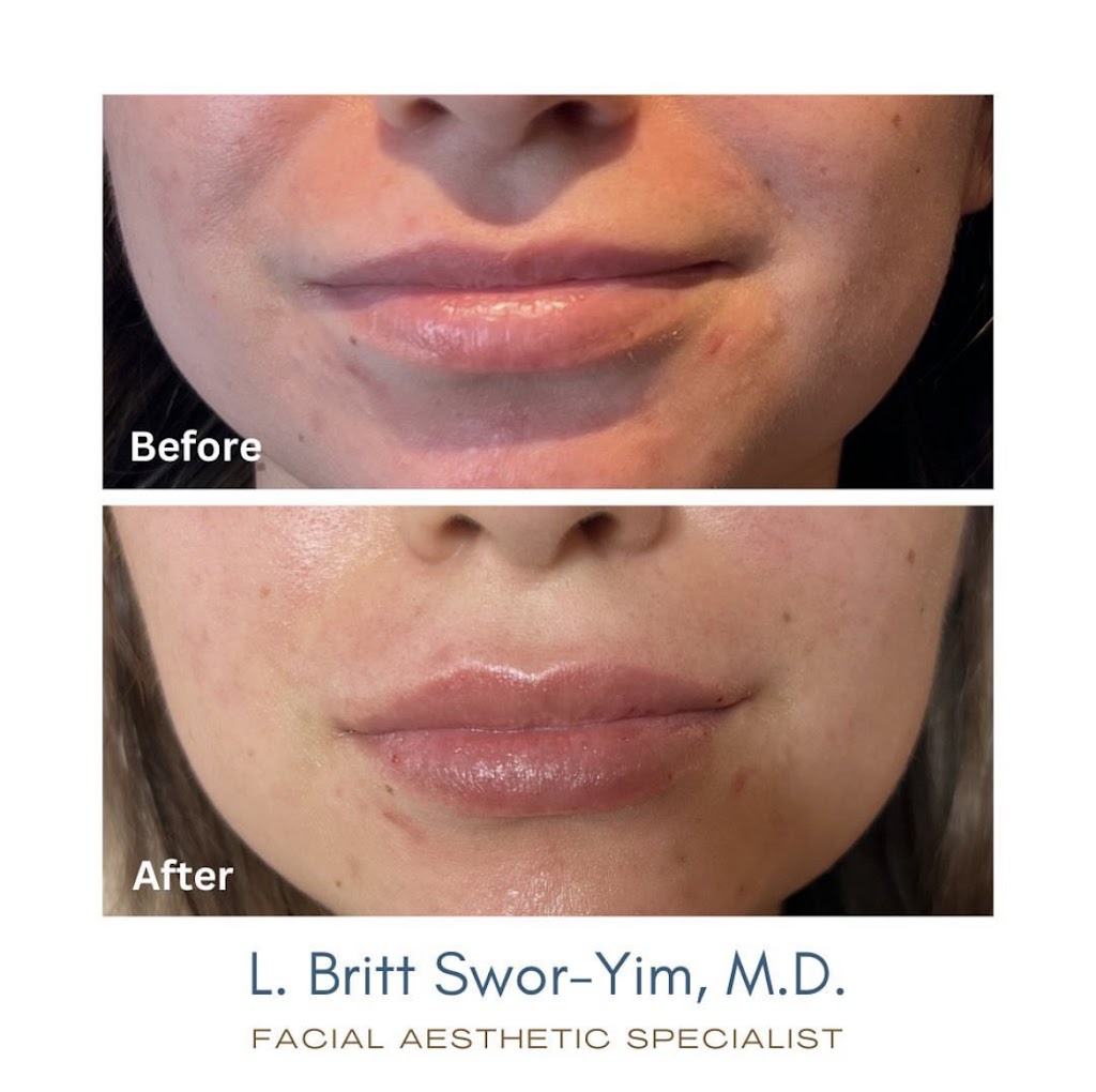 Britt Swor- Yim, MD | Facial Aesthetics Medispa | Botox, Filler | 156 E Napa St, Sonoma, CA 95476 | Phone: (415) 596-1075